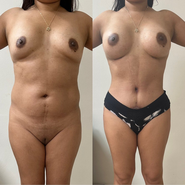 Slider image (9) Dr. Gabriel Sandoval - Plastic Surgeon in Mexico